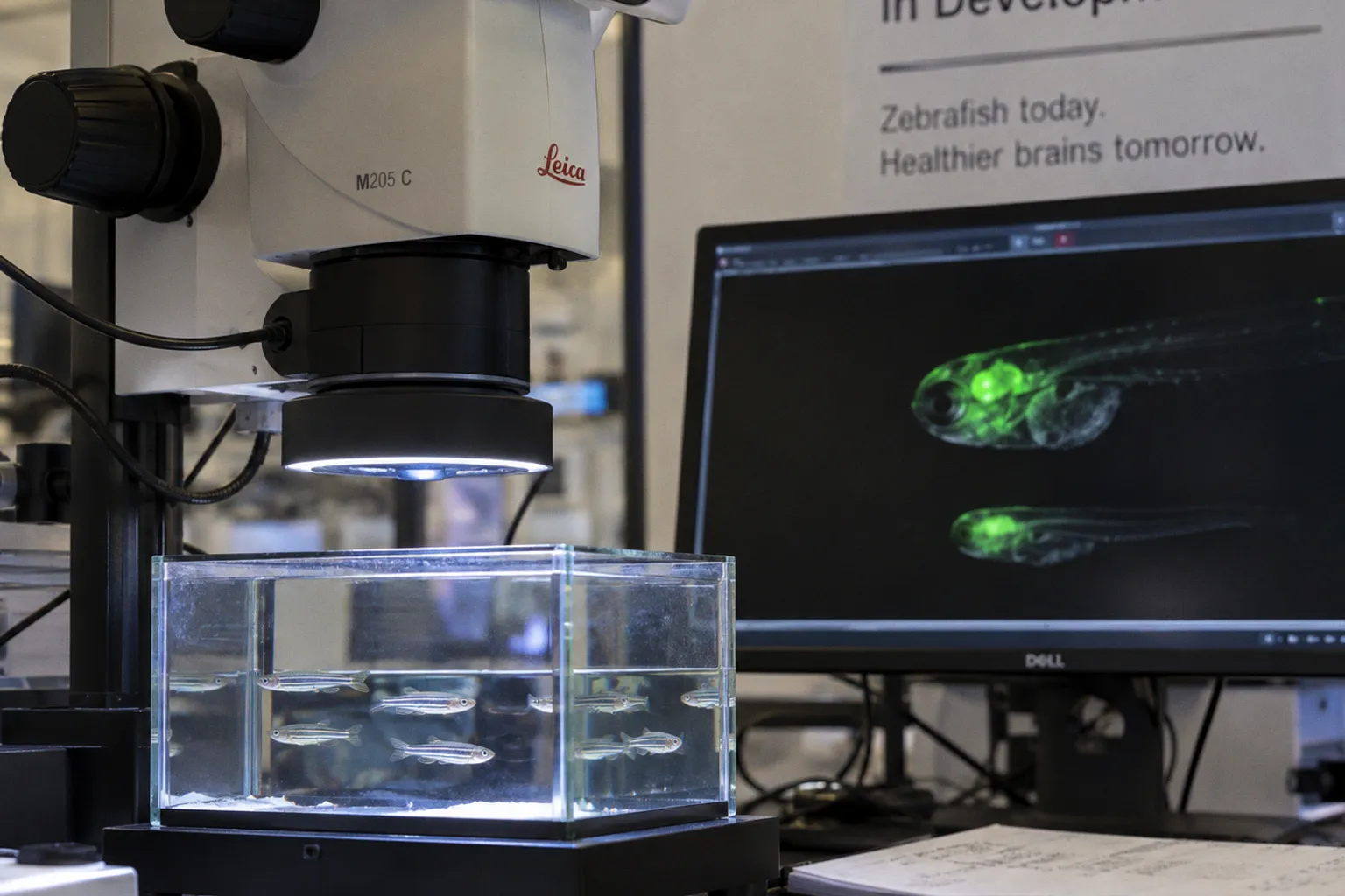 Could Brain Vascular Integrity Be the Missing Link in Alzheimer’s Disease?
