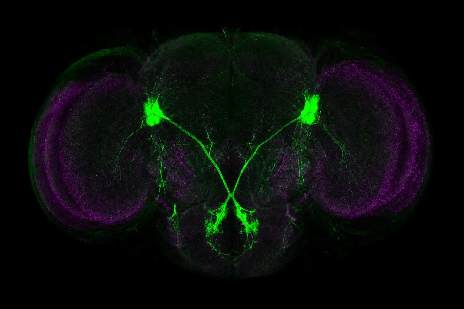 Habenulo-interpeduncular pathway: 4 mapping methods