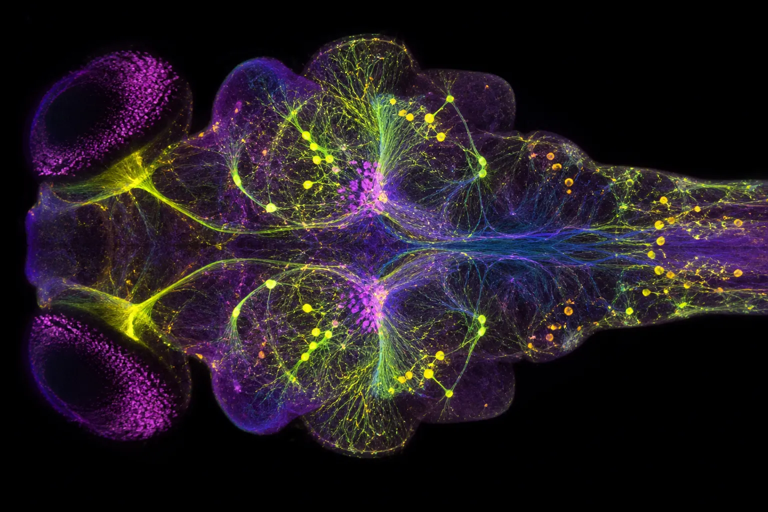 How Zebrafish Brains Reveal the Universal Logic of Sensory Processing